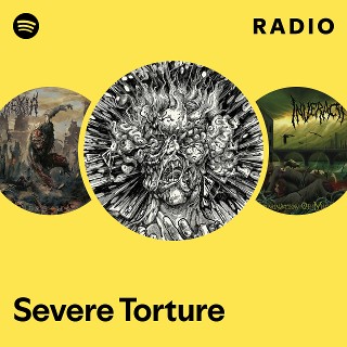 Severe Torture | Spotify